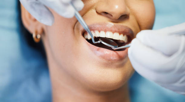Best Emergency Denture Repair in Mount Vernon, IL