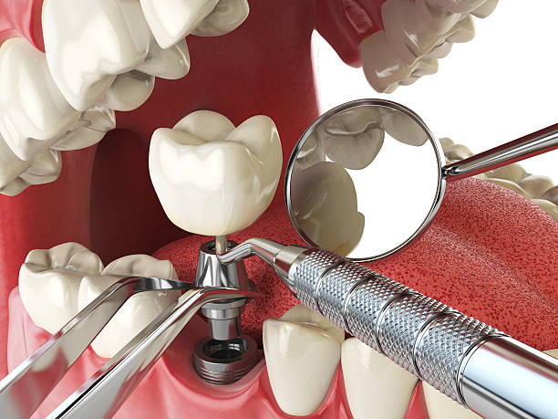 Best Emergency Orthodontic Services in Mount Vernon, IL