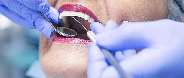Best Emergency Treatment for Dental Infections or Abscesses in Mount Vernon, IL